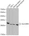 HLA class II histocompatibility antigen, DP beta 1 chain antibody, 15-381, ProSci, Western Blot image 