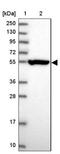 Cartilage Associated Protein antibody, NBP1-94104, Novus Biologicals, Western Blot image 