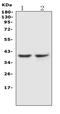 C-C Motif Chemokine Receptor 5 (Gene/Pseudogene) antibody, PA1016, Boster Biological Technology, Western Blot image 
