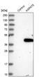 1-Acylglycerol-3-Phosphate O-Acyltransferase 5 antibody, PA5-52721, Invitrogen Antibodies, Western Blot image 