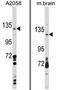 Protein CLEC16A antibody, AP17215PU-N, Origene, Western Blot image 