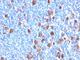 Fascin Actin-Bundling Protein 1 antibody, V2862IHC-7ML, NSJ Bioreagents, Immunohistochemistry paraffin image 