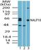 NLR Family Pyrin Domain Containing 10 antibody, PA5-23311, Invitrogen Antibodies, Western Blot image 
