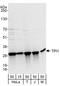 Triosephosphate Isomerase 1 antibody, A303-755A, Bethyl Labs, Western Blot image 