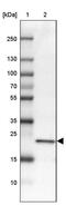 Cytochrome B-245 Chaperone 1 antibody, PA5-61073, Invitrogen Antibodies, Western Blot image 