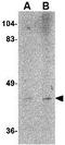 LAG1 longevity assurance homolog 6 antibody, GTX17028, GeneTex, Western Blot image 