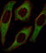 Insulin receptor substrate 2 antibody, abx033681, Abbexa, Western Blot image 