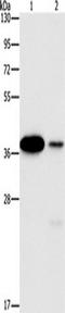 SUMO1 Activating Enzyme Subunit 1 antibody, TA349544, Origene, Western Blot image 