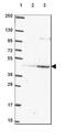 Peroxisomal Biogenesis Factor 12 antibody, NBP2-49599, Novus Biologicals, Western Blot image 