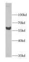 Mannosyl (Alpha-1,3-)-Glycoprotein Beta-1,2-N-Acetylglucosaminyltransferase antibody, FNab05156, FineTest, Western Blot image 