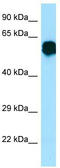 Complement C3b/C4b Receptor 1 Like antibody, TA337758, Origene, Western Blot image 
