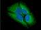 Glycyl-TRNA Synthetase antibody, NBP2-42679, Novus Biologicals, Immunocytochemistry image 