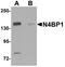 NEDD4 Binding Protein 1 antibody, A12575-1, Boster Biological Technology, Western Blot image 