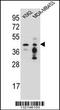 Choline-phosphate cytidylyltransferase A antibody, TA324475, Origene, Western Blot image 