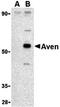 Cell death regulator Aven antibody, orb74441, Biorbyt, Western Blot image 