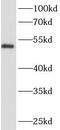 Ankyrin Repeat Domain 13D antibody, FNab00409, FineTest, Western Blot image 