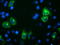 Paraplegin antibody, LS-C336889, Lifespan Biosciences, Immunofluorescence image 