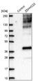 Probable palmitoyltransferase ZDHHC23 antibody, NBP1-82688, Novus Biologicals, Western Blot image 