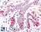 ERLIN2 antibody, LS-B9192, Lifespan Biosciences, Immunohistochemistry paraffin image 