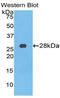 Transferrin Receptor antibody, MBS2026361, MyBioSource, Western Blot image 