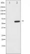 3-Phosphoinositide Dependent Protein Kinase 1 antibody, TA325773, Origene, Western Blot image 