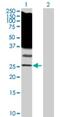 RAS Like Family 11 Member B antibody, H00065997-D01P, Novus Biologicals, Western Blot image 