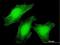 La Ribonucleoprotein Domain Family Member 6 antibody, H00055323-B01P, Novus Biologicals, Immunocytochemistry image 