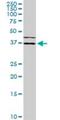 ISL LIM Homeobox 1 antibody, H00003670-M01, Novus Biologicals, Western Blot image 