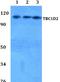 TBC1 Domain Family Member 2 antibody, A09458, Boster Biological Technology, Western Blot image 