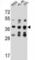 Forkhead Box D4 Like 5 antibody, abx026606, Abbexa, Western Blot image 