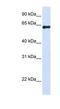 DENN Domain Containing 6A antibody, NBP1-56753, Novus Biologicals, Western Blot image 