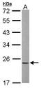 Rac Family Small GTPase 1 antibody, TA308948, Origene, Western Blot image 