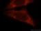 eIF4E antibody, 11149-1-AP, Proteintech Group, Immunofluorescence image 