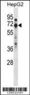 Zinc finger protein 395 antibody, 57-825, ProSci, Western Blot image 