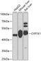 Cytochrome P450 Family 7 Subfamily A Member 1 antibody, 13-763, ProSci, Western Blot image 