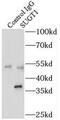 SGT1 Homolog, MIS12 Kinetochore Complex Assembly Cochaperone antibody, FNab08374, FineTest, Immunoprecipitation image 
