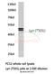 LYN Proto-Oncogene, Src Family Tyrosine Kinase antibody, A01424T501, Boster Biological Technology, Western Blot image 