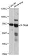 Sodium-dependent serotonin transporter antibody, A14171, ABclonal Technology, Western Blot image 