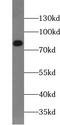 Ald antibody, FNab00035, FineTest, Western Blot image 