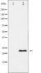 Metalloproteinase inhibitor 2 antibody, TA325939, Origene, Western Blot image 