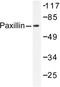 Paxillin antibody, AP06280PU-N, Origene, Western Blot image 