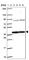 PIH1 Domain Containing 1 antibody, HPA047258, Atlas Antibodies, Western Blot image 