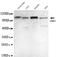 Ubiquitin Like With PHD And Ring Finger Domains 1 antibody, MBS475085, MyBioSource, Western Blot image 