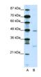 MAX Dimerization Protein 4 antibody, orb324432, Biorbyt, Western Blot image 