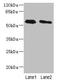 Phospholipase D Family Member 4 antibody, LS-C371736, Lifespan Biosciences, Western Blot image 