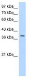 La Ribonucleoprotein Domain Family Member 7 antibody, TA343849, Origene, Western Blot image 