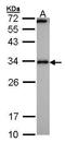 Regulator Of Calcineurin 1 antibody, GTX100245, GeneTex, Western Blot image 