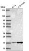 Serine/threonine-protein kinase Nek6 antibody, HPA056828, Atlas Antibodies, Western Blot image 