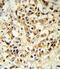 Fibroblast Growth Factor Receptor 1 antibody, 63-084, ProSci, Immunohistochemistry paraffin image 