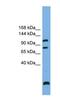 Protein Phosphatase 6 Regulatory Subunit 1 antibody, NBP1-57815, Novus Biologicals, Western Blot image 